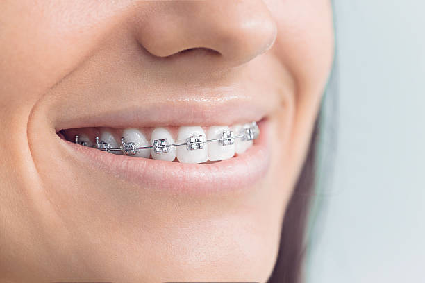 Best Dental Fillings (Composite and Amalgam)  in New Lenox, IL
